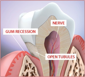 Tooth Image | Bellingham Dentist | Dental Implants | Northside Dental Care