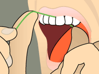 Flossing | Bellingham Dentist | Dental Implants | Northside Dental Care