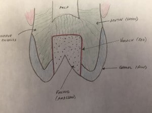 Fullsizeoutput F X | Bellingham Dentist | Dental Implants | Northside Dental Care