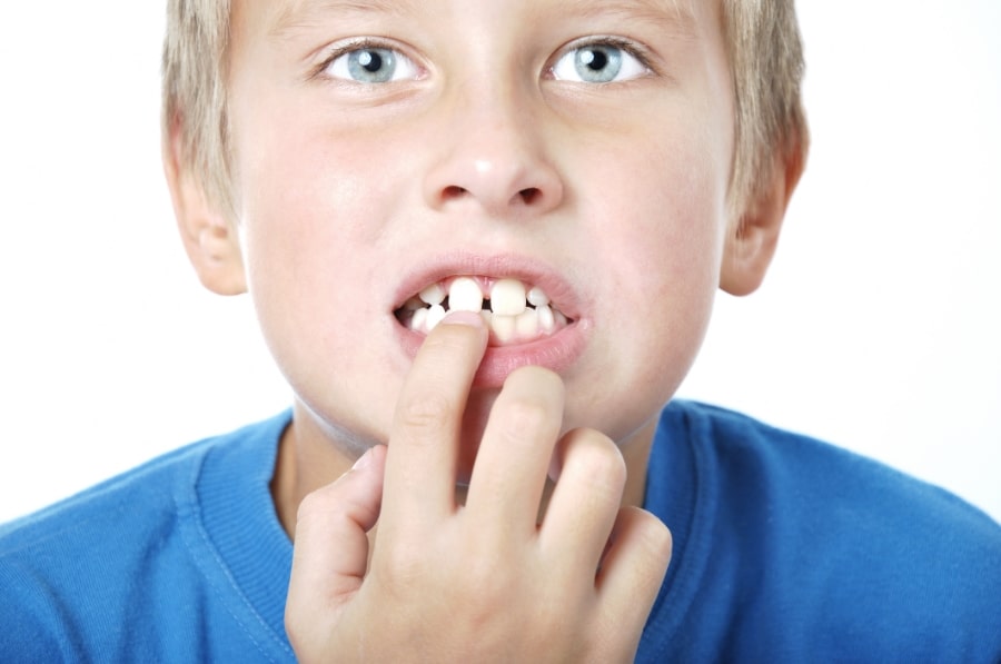 Tooth Pain | Bellingham Dentist | Dental Implants | Northside Dental Care