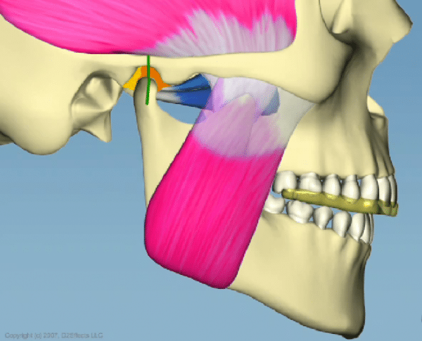 WHAT CAUSES TMJ PAIN AND WHAT’S THE CURE? | Northside Dental Care ...