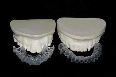 Whitening Tray | Bellingham Dentist | Dental Implants | Northside Dental Care