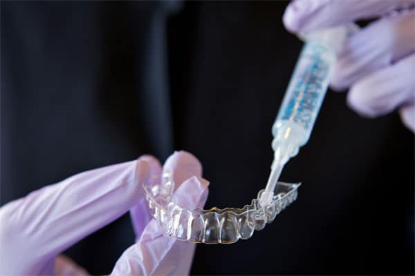 Whitening Tray | Bellingham Dentist | Dental Implants | Northside Dental Care